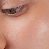 Scandy Spot the F Off Invisible Blemish Patches